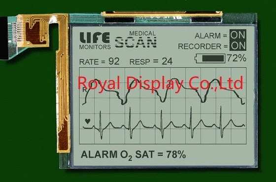 320*240 FSTN Μοντέλο LCD Μονοχρώμιο Για Ιατρική Σάρωση θετικό
